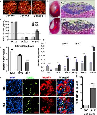 Exploring lncRNAs associated with human pancreatic islet cell death induced by transfer of adoptive lymphocytes in a humanized mouse model